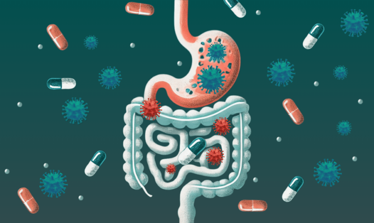 Gut and Antibiotics